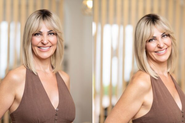 Donna sorridente con taglio medio biondo e frangia, esempio di risultato naturale ottenuto con il sistema Hairdreams MicroLines FreeStyle.